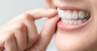 Pandemic-proof? Align Technology sold a record number of clear aligners in 2020