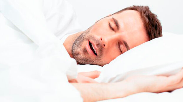 Respirare con la bocca durante il sonno aumenta il rischio di carie