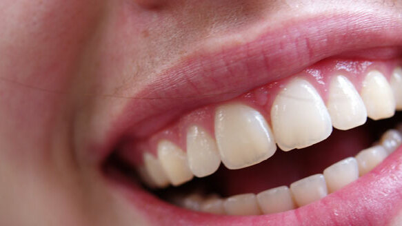 AAID: August is Dental Implant Month