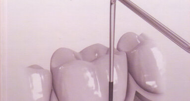 Prikaz knjige Klinička parodontologija