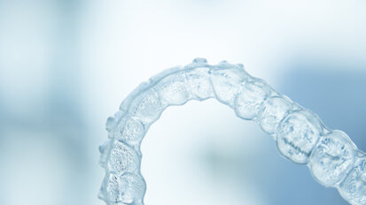 Orthodontists concerned about the emergence of DIY clear aligners