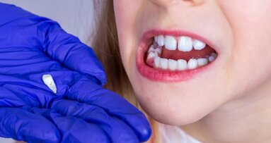 Růstové linie dočasných zubů mohou pomoci vyhodnotit riziko vzniku duševních poruch
