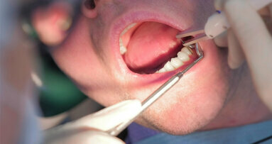 Un nuevo gel dental reduce los síntomas periodontales