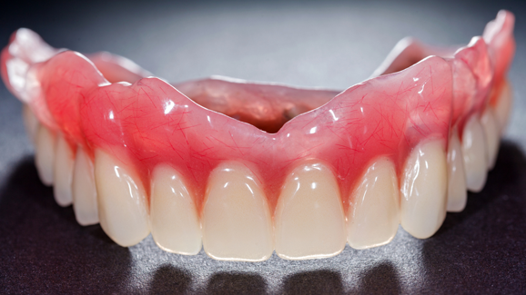 Betrugsprozess um Zahnprothese