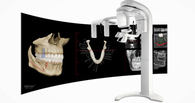 Osstem’s OneGuide makes implant surgery easy, convenient and safe even in difficult cases