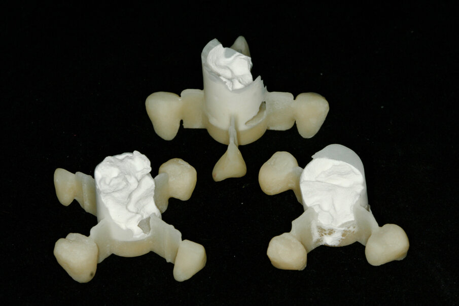 Fig. 18: Ceramic crowns after completion of the press procedure