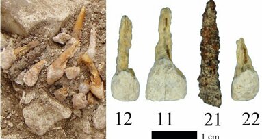 Археолози откриват древен зъбен имплантат