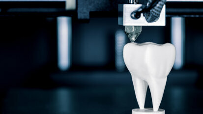 Study highlights benefits of in-house 3D printing for immediate dental implant placement