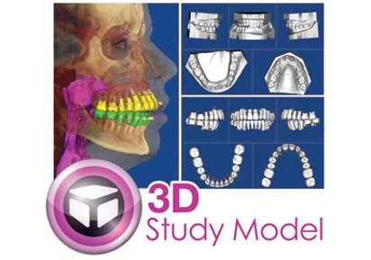 Dolphin 3D Digital Study Model software