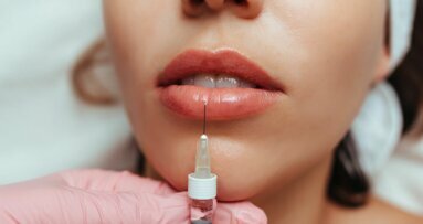 Hyaluronzuurfillers: kunnen vollere lippen te vol zijn?