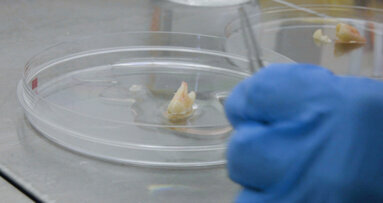 Researchers investigate possibility of regrowing teeth