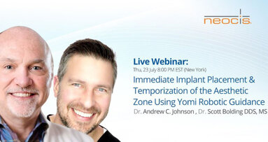 Live Webinar: Immediate implant placement and temporization
