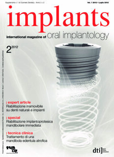 implants Italy No. 2, 2012