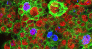 Stammzellen beeinflussen Tumorwachstum im Hirn