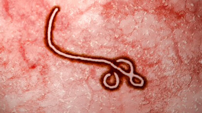 Le autorità sanitarie offrono ai dentisti una guida sull’Ebola