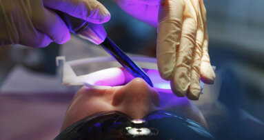 Scientists to develop novel dental restorative material