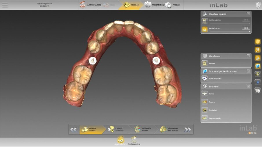 Fig. 10_Il rendering con il software Dentsply Sirona inLab.