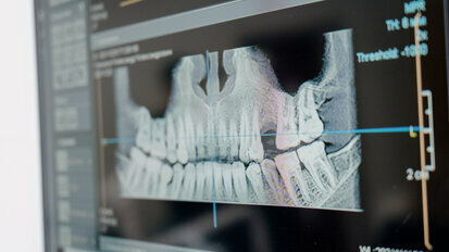 O futuro da ortodontia é digital