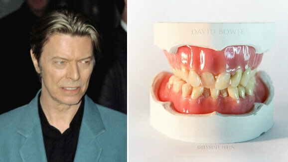 Interview: “Bowie’s teeth were like everything else about him: different”