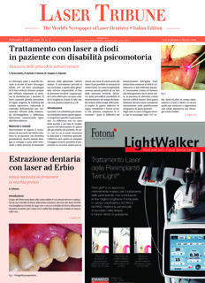 Laser Tribune Italy No. 2, 2017