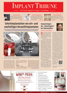 Implant Tribune Switzerland No. 2, 2014