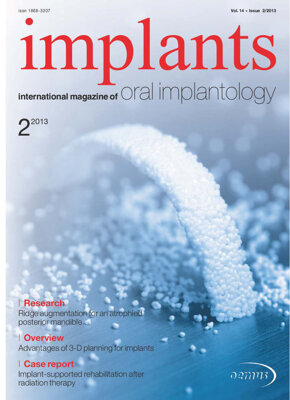 implants international No. 2, 2013