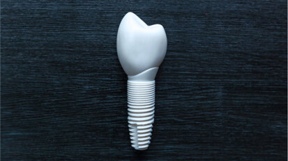 New production process promises to make dental ceramic implants more resilient