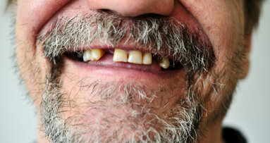 Dois estudos separados revelam um futuro emocionante na bioengenharia de dentes