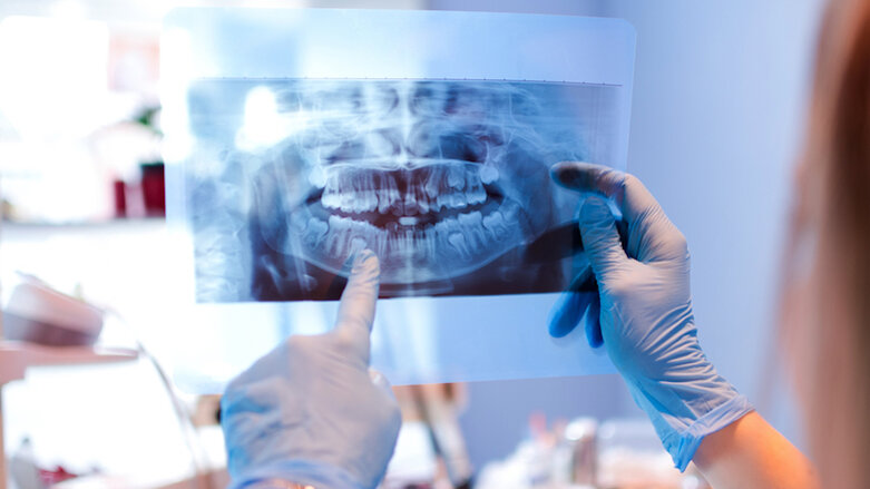 Study shows dentists may underdiagnose when under time pressure