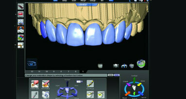 CAD/CAM dentistry and the laboratory technician: Partners in success