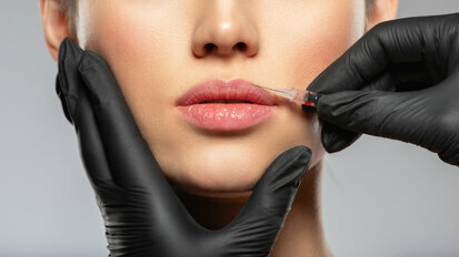 I dentisti che forniscono procedure cosmetiche iniettabili esortati a essere assicurati