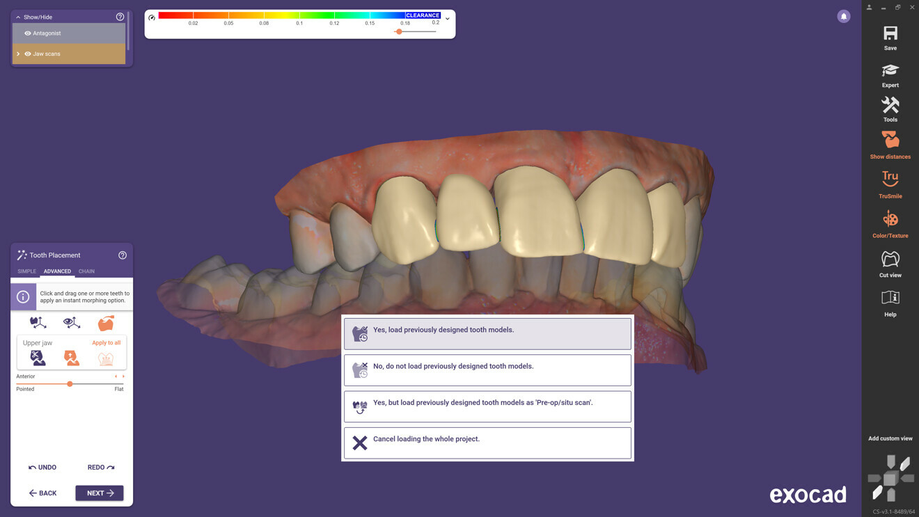 Dental professionals can reuse anatomical designs for multiple restorations to save valuable time when creating mock-up smiles and temporary and final restorations.