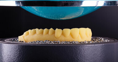 3D tisk ve stomatologii: Požadavky na materiály a zpracování