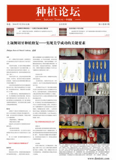 Implant Tribune China No. 2, 2016