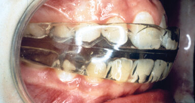 Preventive orthodontics: Is it a logical and predictive procedure?