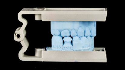 Modele 3D w stomatologii