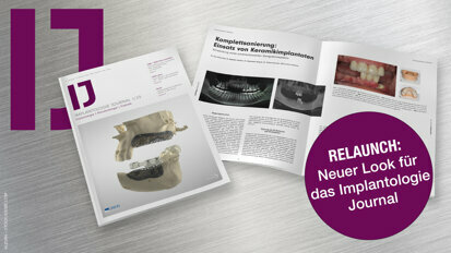 Relaunch: Neuer Look für das Implantologie Journal