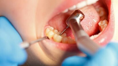 Dentista de Singapura é multado por má conduta profissional