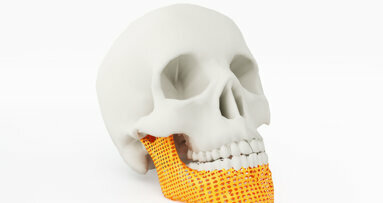 Đánh giá toàn diện mới về in 3D trong phẫu thuật miệng và hàm mặt