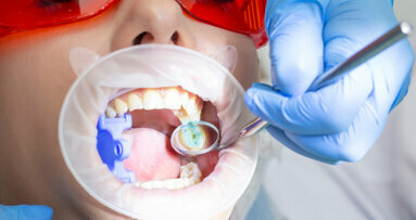 Dental caries prevalence continues to affect Australian adults, study says