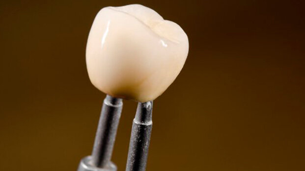 Indagine sull’usura di varie ceramiche per il restauro dei denti primari
