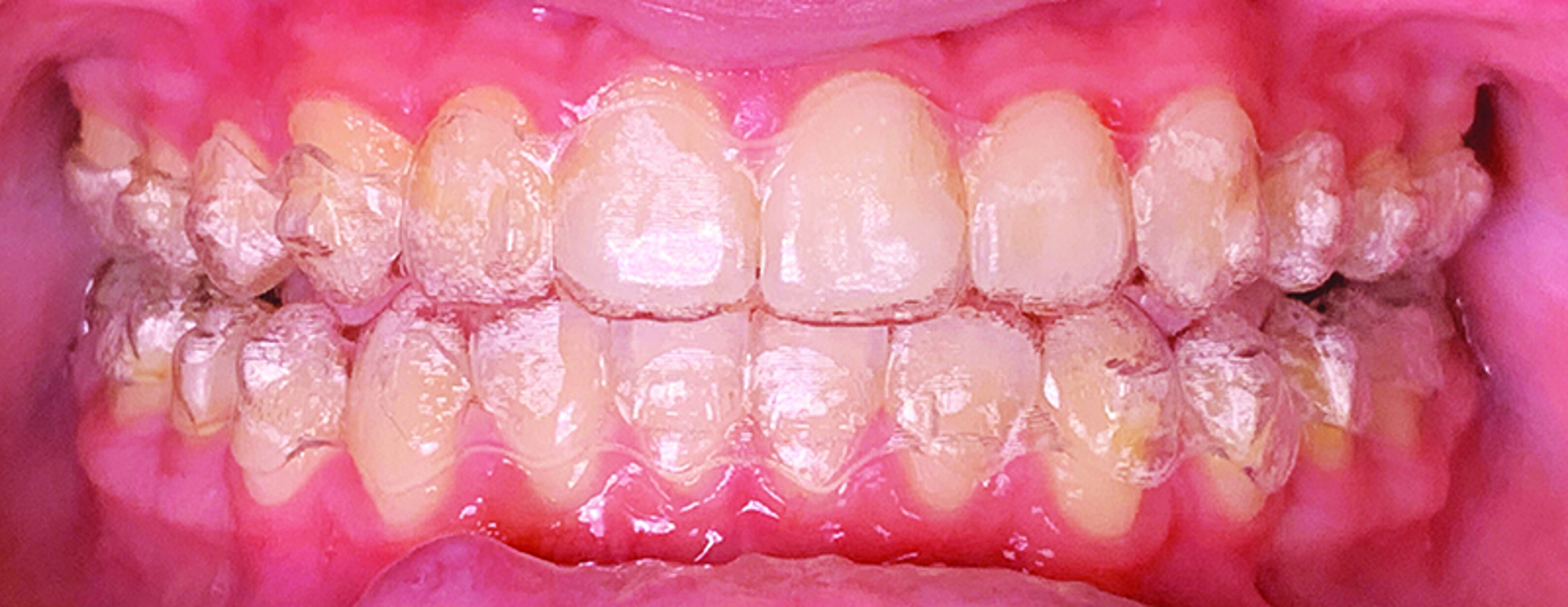 Dental News A predictable orthodontic digital workflow