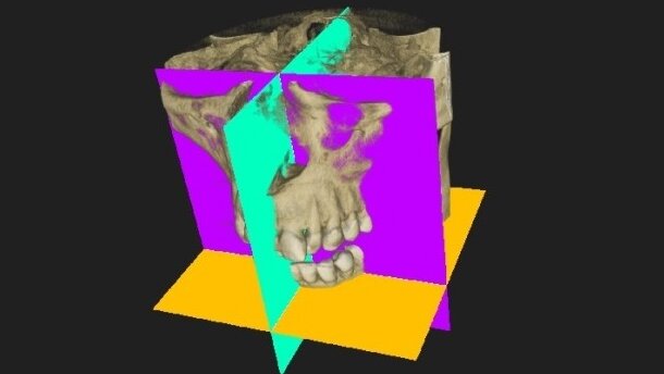 Tomografia stożkowa – innowacyjny system obrazowania