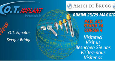 Bononia Implant System: un protocollo completo applicabile a tutti i tipi di impianti