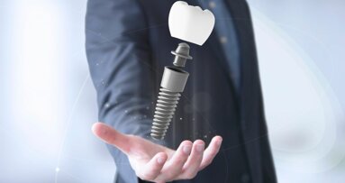 AI-powered AR systems will revolutionize implantology