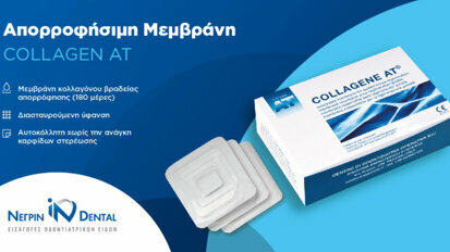 Collagen AT – Μεμβράνη βραδείας απορρόφησης | ΝΕΓΡΙΝ ΙΝ Dental
