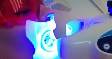 BlancOne Click a supporto della crescita dello studio dentistico
