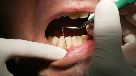 Large number of Brits unaware of consequences of poor oral health