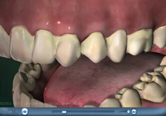 Free Web-based Patient Education Software, CurveEd, released by Curve Dental