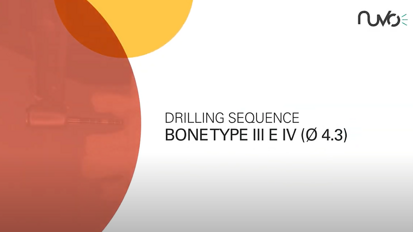 InternalFIT Drilling Sequence Bone Type III&IV